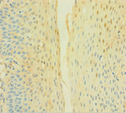 Immunohistochemistry of paraffin-embedded human tonsil tissue using CSB-PA006325LA01HU at dilution of 1:100