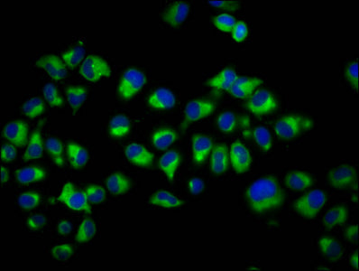 Immunofluorescence staining of Hela cells with CSB-PA006326LA01HU at 1:200, counter-stained with DAPI. The cells were fixed in 4% formaldehyde, permeabilized using 0.2% Triton X-100 and blocked in 10% normal Goat Serum. The cells were then incubat...