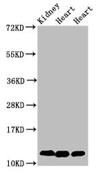Western Blot Positive WB detected in: Rat kidney tissue, Rat heart tissue, Mouse heart tissue All lanes: CYCS antibody at 2µg/ml Secondary Goat polyclonal to rabbit IgG at 1/50000 dilution Predicted band size: 12 kDa Observed band size: 12 kDa