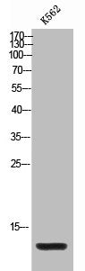 Western Blot analysis of K562 cells using MIP-1b Polyclonal Antibody