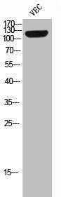 Western Blot analysis of VEC cells using Phospho-Tie-2 (Y992) Polyclonal Antibody