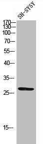 Western Blot analysis of SH-SY5Y cells using Phospho-Troponin I-C (S22/S23) Polyclonal Antibody