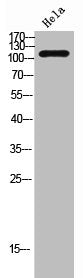 Western Blot analysis of HeLa cells using Na+/K+-ATPase α1 Polyclonal Antibody