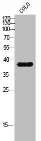 Western Blot analysis of COLO cells using SR-5B Polyclonal Antibody
