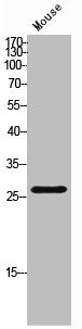 Western Blot analysis of mouse cells using Troponin I-C Polyclonal Antibody