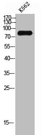 Western Blot analysis of K562 cells using P-cadherin Polyclonal Antibody