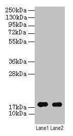 Western blot All lanes: ATP5F1D antibody at 2µg/ml Lane 1: EC109 whole cell lysate Lane 2: 293T whole cell lysate Secondary Goat polyclonal to rabbit IgG at 1/15000 dilution Predicted band size: 18 kDa Observed band size: 18 kDa