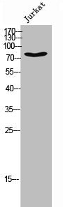 Western Blot analysis of JK cells using Phospho-DRP1 (S637) Polyclonal Antibody