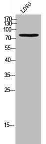 Western Blot analysis of LOVO cells using T-cadherin Polyclonal Antibody