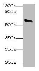 Western blot All lanes: CYP11A1 antibody at 2µg/ml + Rat adrenal gland tissue Secondary Goat polyclonal to rabbit IgG at 1/10000 dilution Predicted band size: 61, 43 kDa Observed band size: 61 kDa