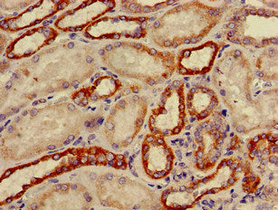 Immunohistochemistry of paraffin-embedded human kidney tissue using CSB-PA006391LA01HU at dilution of 1:100