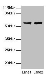 Western blot All lanes: CYP17A1 antibody at 2µg/ml Lane 1: Hela whole cell lysate Lane 2: A549 whole cell lysate Secondary Goat polyclonal to rabbit IgG at 1/10000 dilution Predicted band size: 58 kDa Observed band size: 58 kDa