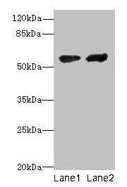 Western blot All lanes: CYP17A1 antibody at 12µg/ml Lane 1: Hela whole cell lysate Lane 2: A549 whole cell lysate Secondary Goat polyclonal to rabbit IgG at 1/10000 dilution Predicted band size: 58 kDa Observed band size: 58 kDa