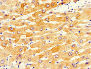 Immunohistochemistry of paraffin-embedded human liver tissue using CSB-PA006396LA01HU at dilution of 1:100