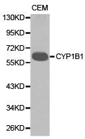 Western blot analysis of extracts of CEM cell lines, using CYP1B1 antibody.