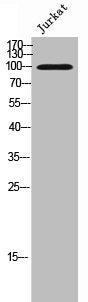 Western Blot analysis of Jurkat cells using LI-cadherin Polyclonal Antibody