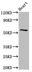 Western Blot Positive WB detected in: Rat heart tissue All lanes: CYP2A6 antibody at 3ug/ml Secondary Goat polyclonal to rabbit IgG at 1/50000 dilution Predicted band size: 57 kDa Observed band size: 57 kDa