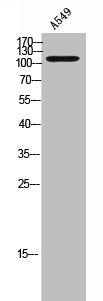 Western Blot analysis of A549 cells using ACK Polyclonal Antibody