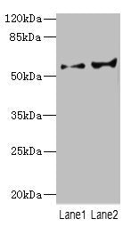 Western blot All lanes: CYP2C18 antibody at 5.98ug/ml Lane 1: HL60 whole cell lysate Lane 2: 293T whole cell lysate Secondary Goat polyclonal to rabbit IgG at 1/10000 dilution Predicted band size: 56, 49 kDa Observed band size: 56 kDa