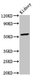 Western Blot Positive WB detected in: Mouse kidney tissue All lanes: CYP2C19 antibody at 4ug/ml Secondary Goat polyclonal to rabbit IgG at 1/50000 dilution Predicted band size: 56 kDa Observed band size: 56 kDa