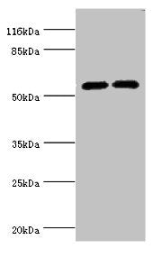 Western blot All lanes: CYP2E1 antibody at 12µg/ml Lane 1: Jurkat whole cell lysate Lane 2: Mouse liver tissue Secondary Goat polyclonal to rabbit IgG at 1/10000 dilution Predicted band size: 57 kDa Observed band size: 57 kDa