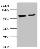 Western blot All lanes: CYP2J2 antibody at 4ug/ml Lane 1: Mouse skeletal muscle tissue Lane 2: Rat liver tissue Secondary Goat polyclonal to rabbit IgG at 1/10000 dilution Predicted band size: 58 kDa Observed band size: 58 kDa