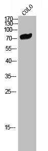 Western Blot analysis of COLO cells using CNK1 Polyclonal Antibody