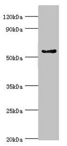 Western blot All lanes: Cytochrome P450 3A5 antibody at 9ug/ml + Mouse liver tissue Secondary Goat polyclonal to rabbit IgG at 1/10000 dilution Predicted band size: 58, 16 kDa Observed band size: 58 kDa