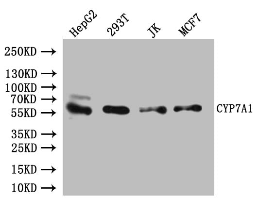Western Blot Positive WB detected in: HepG2 whole cell lysate, 293T whole cell lysate, JK whole cell lysate, MCF7 whole cell lysate All lanes:CYP7A1 Antibody at 1:1000 Secondary Goat polyclonal to rabbit IgG at 1/50000 dilution Predicted band size...