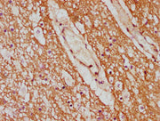 IHC image of CSB-PA006461LA01HU diluted at 1:600 and staining in paraffin-embedded human brain tissue performed on a Leica BondTM system. After dewaxing and hydration, antigen retrieval was mediated by high pressure in a citrate buffer (pH 6.0). S...