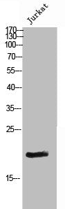 Western Blot analysis of JK cells using Phospho-p16 (S326) Polyclonal Antibody