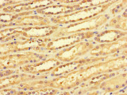 Immunohistochemistry of paraffin-embedded human kidney tissue using CSB-PA006482LA01HU at dilution of 1:100