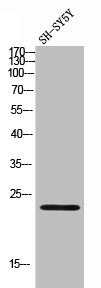 Western Blot analysis of SH-SY5Y cells using CDKN3 Polyclonal Antibody