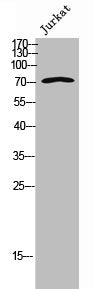 Western Blot analysis of Jurkat cells using Hec1 Polyclonal Antibody