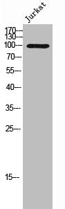 Western Blot analysis of JK cells using Phospho-Vav3 (Y173) Polyclonal Antibody