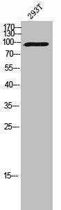 Western Blot analysis of 293T-UV cells using Vav3 Polyclonal Antibody