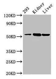 Western Blot Positive WB detected in: 293 whole cell lysate, Mouse kidney tissue, Mouse liver tissue All lanes: DBT antibody at 4.3µg/ml Secondary Goat polyclonal to rabbit IgG at 1/50000 dilution Predicted band size: 54 kDa Observed band size: 54...