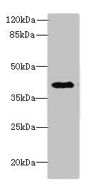 Western blot All lanes: DCN antibody at 6µg/ml + Jurkat whole cell lysate Secondary Goat polyclonal to rabbit IgG at 1/10000 dilution Predicted band size: 40 kDa Observed band size: 40 kDa
