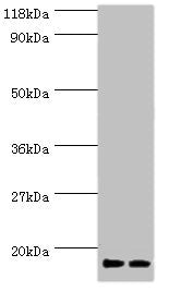 Western blot All lanes: RPS19 antibody at 2µg/ml Lane 1: EC109 whole cell lysate Lane 2: 293T whole cell lysate Secondary Goat polyclonal to rabbit IgG at 1/15000 dilution Predicted band size: 17 kDa Observed band size: 17 kDa