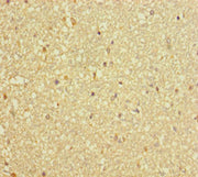 Immunohistochemistry of paraffin-embedded human brain tissue using CSB-PA006566LA01HU at dilution of 1:100
