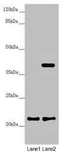 Western blot All lanes: DCTN6 antibody at 3.5 ug/ml Lane 1: A549 whole cell lysate Lane 2: U251 whole cell lysate Secondary Goat polyclonal to rabbit IgG at 1/10000 dilution Predicted band size: 21 kDa Observed band size: 21, 40 kDa