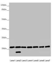 Western blot All lanes: DCTN6 antibody at 3.03 ug/ml Lane 1: Mouse lung tissue Lane 2: Mouse gonadal tissue Lane 3: A549 whole cell lysate Lane 4: U251 whole cell lysate Lane 5: Mouse thymus tissue Lane 6: Rat brain tissue Lane 7: Mouse stomach ti...