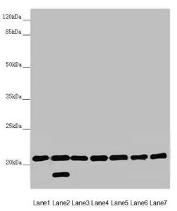 Western blot All lanes: DCTN6 antibody at 3.03 ug/ml Lane 1: Mouse lung tissue Lane 2: Mouse gonadal tissue Lane 3: A549 whole cell lysate Lane 4: U251 whole cell lysate Lane 5: Mouse thymus tissue Lane 6: Rat brain tissue Lane 7: Mouse stomach ti...