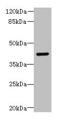 Western blot All lanes: DCX antibody at 8µg/ml + Mouse brain tissue Secondary Goat polyclonal to rabbit IgG at 1/10000 dilution Predicted band size: 41 kDa Observed band size: 41 kDa
