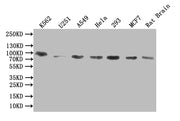 Western Blot Positive WB detected in: K562 whole cell lysate, U251 whole cell lysate, A549 whole cell lysate, Hela whole cell lysate, 293 whole cell lysate, MCF7 whole cell lysate, Rat Brain tissue lysate All lanes: DDHD2 antibody at 1:1000 Second...