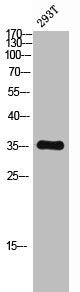 Western Blot analysis of 293T cells using C/EBP β Polyclonal Antibody