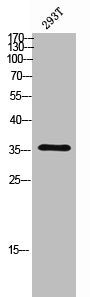 Western Blot analysis of 293T cells using C/EBP β Polyclonal Antibody