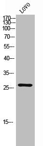 Western Blot analysis of LOVO cells using C/EBP δ/ε Polyclonal Antibody