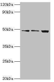 Western blot All lanes: ATP-dependent RNA helicase DDX39A antibody at 2ug/ml Lane 1: A431 whole cell lysate Lane 2: 293T whole cell lysate Lane 3: HepG2 whole cell lysate Secondary Goat polyclonal to rabbit IgG at 1/10000 dilution Predicted band s...