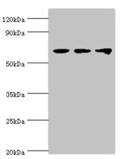 Western blot All lanes: Probable ATP-dependent RNA helicase DDX5 antibody at 3ug/ml Lane 1: NIH/3T3 whole cell lysate Lane 2: Hela whole cell lysate Lane 3: 293T whole cell lysate Secondary Goat polyclonal to rabbit IgG at 1/10000 dilution Predict...